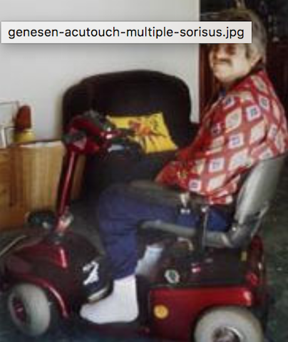 -genesen-acutouch-multiple-sclerosis-4.png